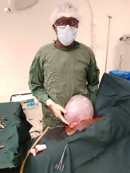 Burkina : Un kyste ovarien extrait avec succès